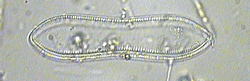 cymatopleura.gif